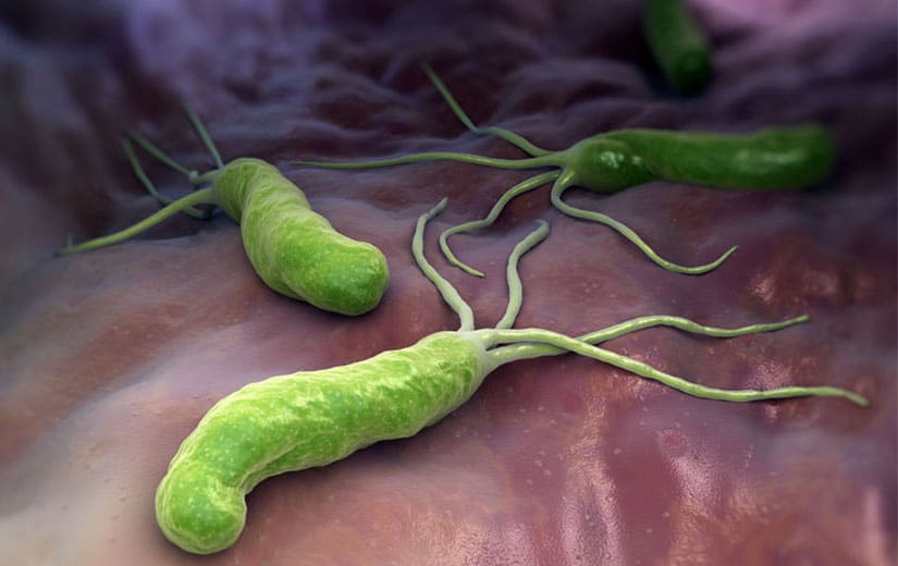 Helicobacter Pylori Traitement Naturel