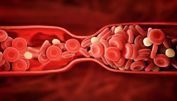 Cholesterol 