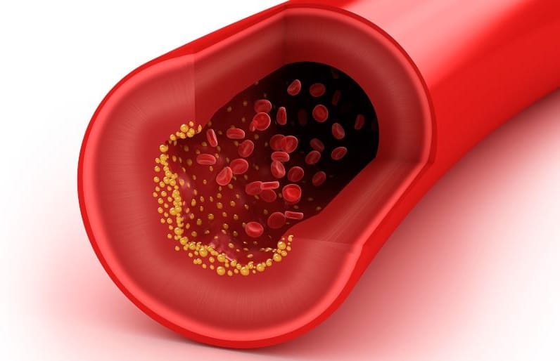Cholesterol