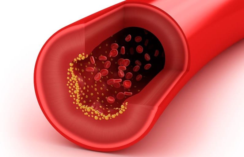 Cholesterol 