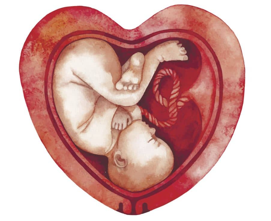 Dessin D'un Placenta Preavia