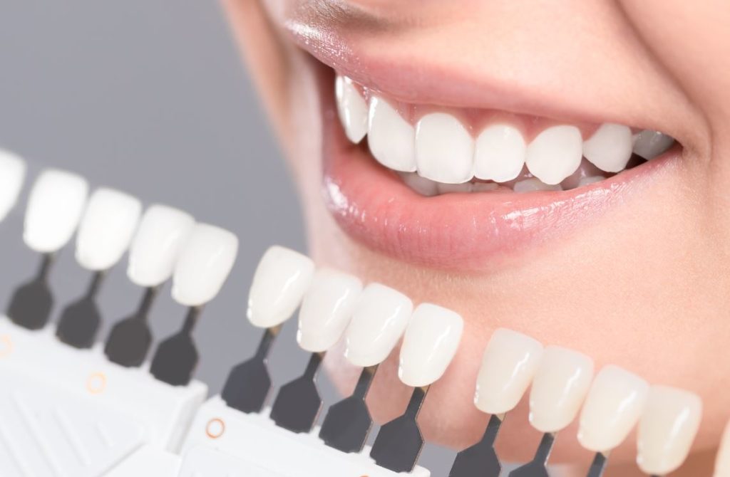 Blanchir Dents
