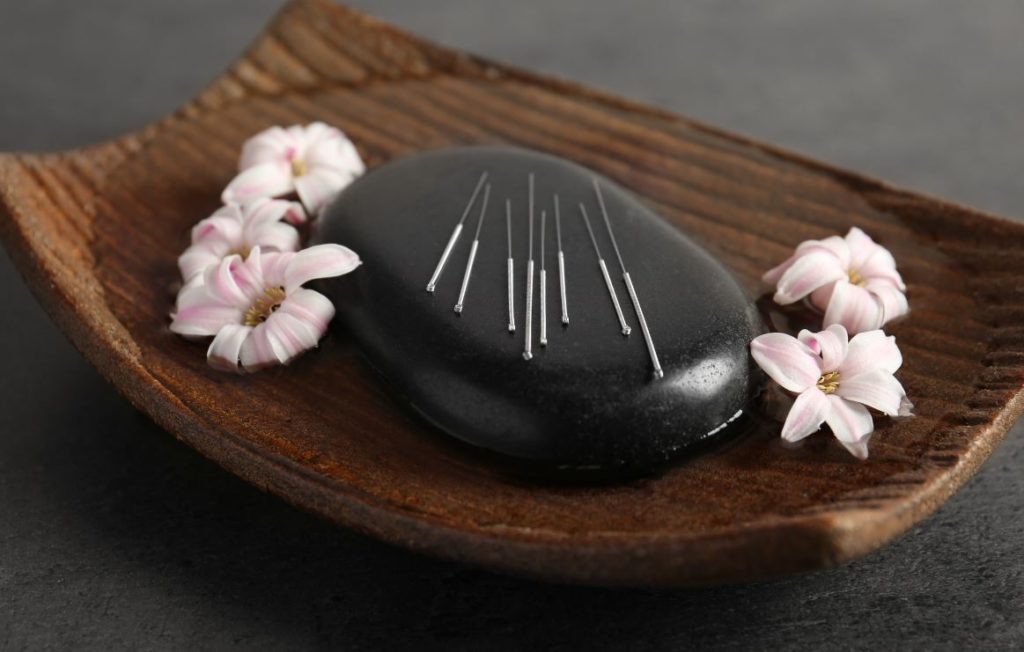Acupuncture Medecine Maigrir