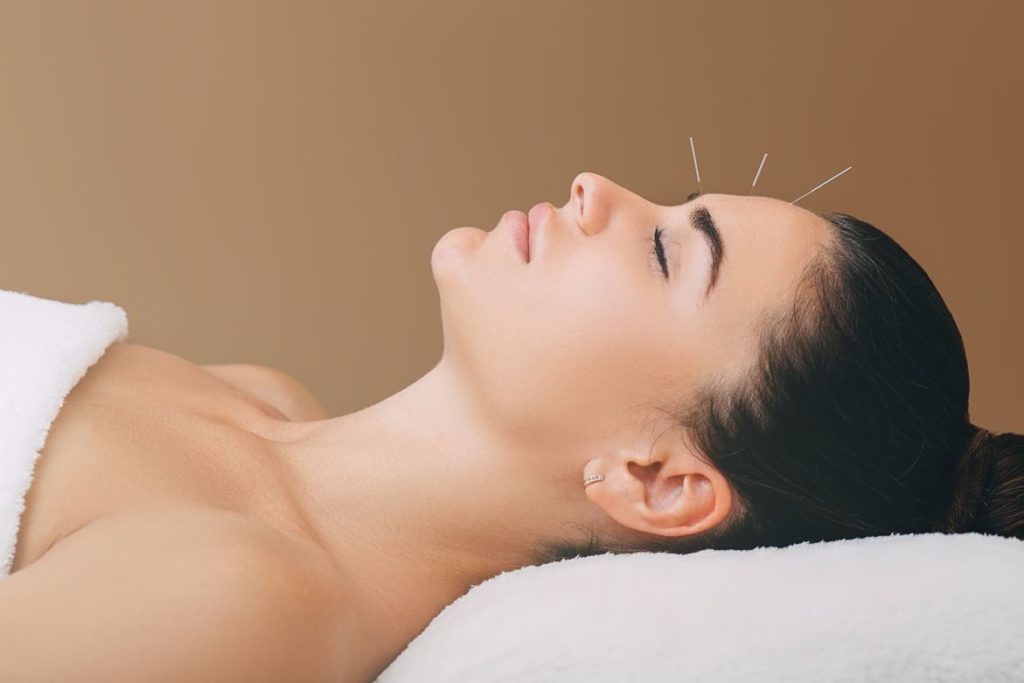 Acupuncture Mincir