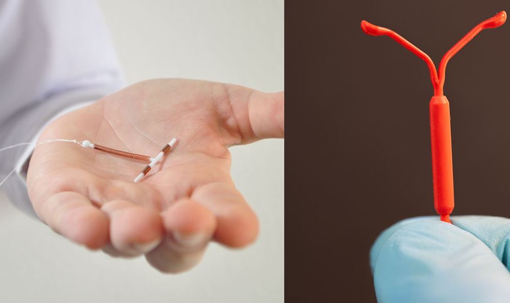 Sterilet Cuivre Et Sterilet Hormonal