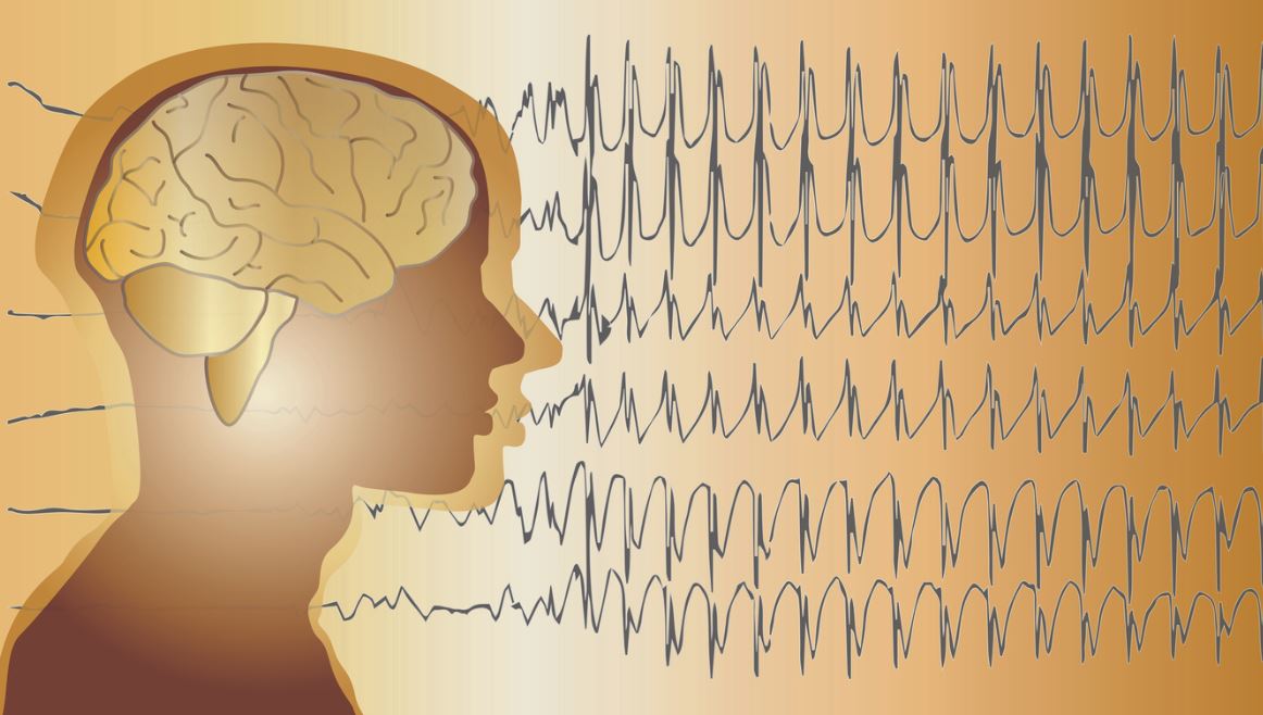 Epilepsie Cerveau