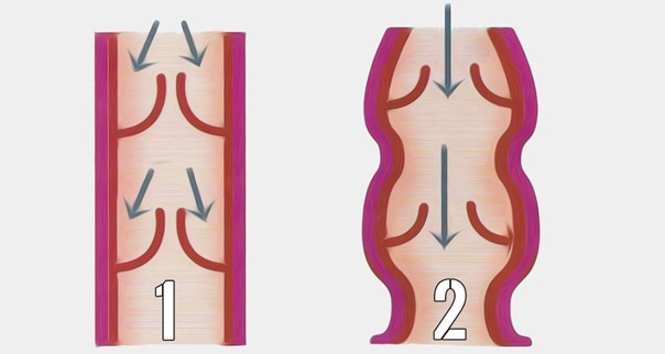 Problèmes veines