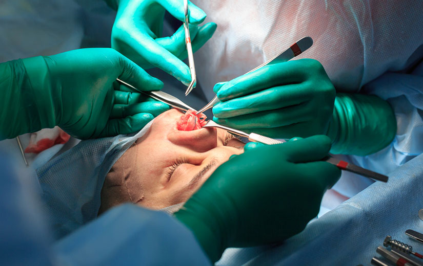 Rhinoplastie Reconstructrice