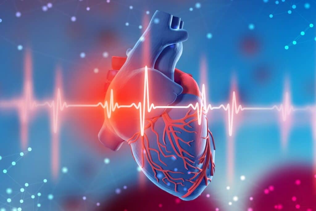 Coeur Infarctus