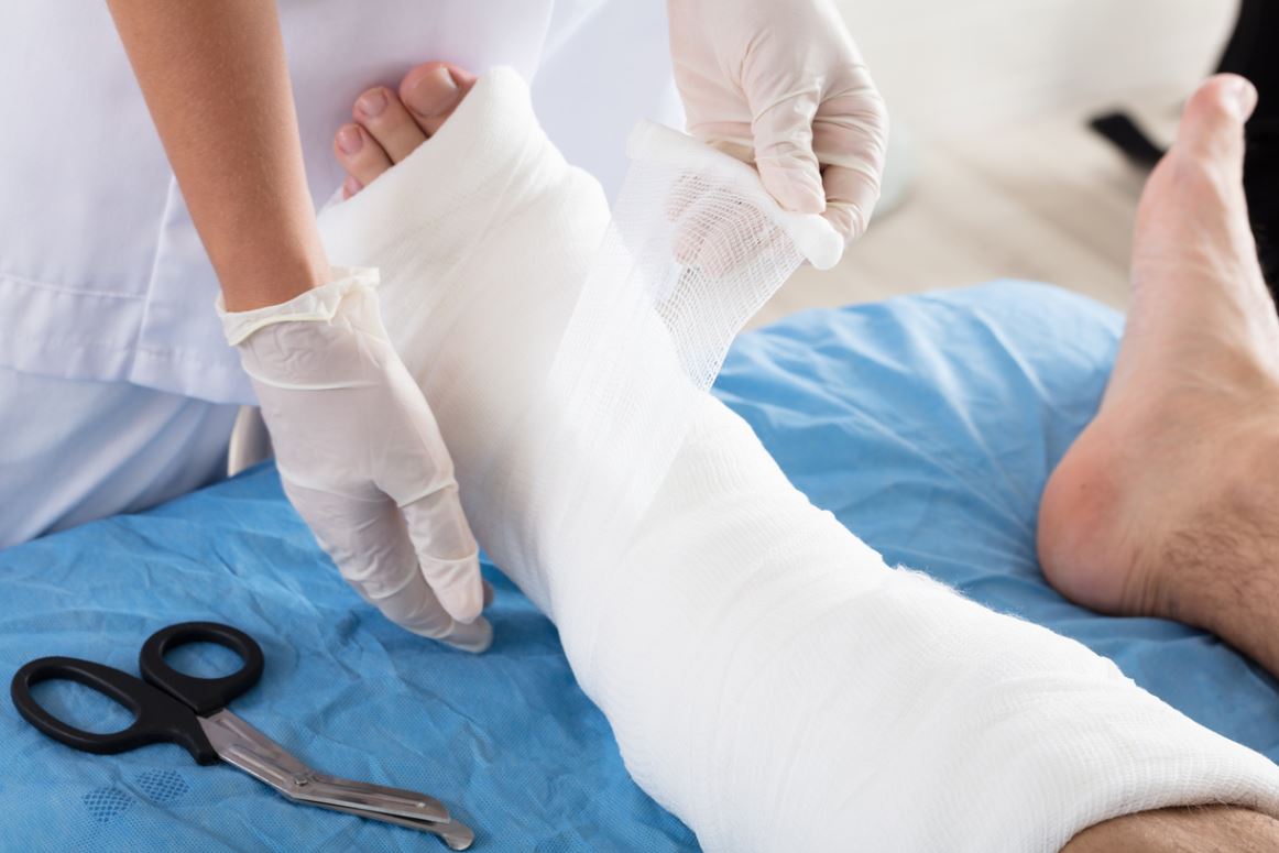 Poser un plâtre après un accident  raisons et techniques