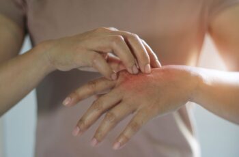 Psoriasis Maladie
