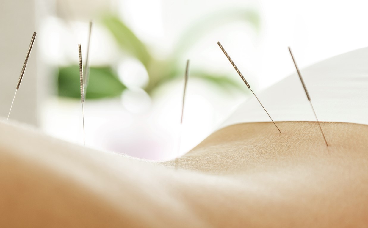 Acupuncture