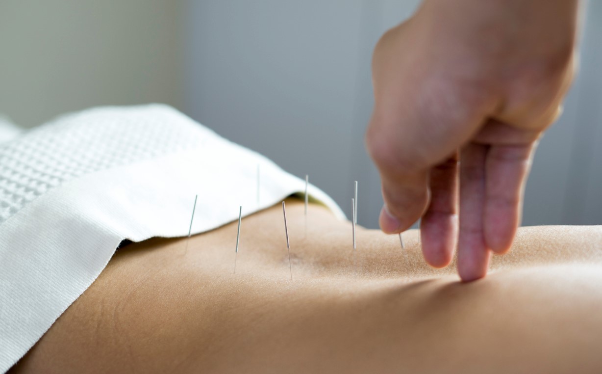 Bienfaits Acupuncture