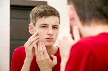 Un adolescent avec de l'acné se regarde dans le miroir