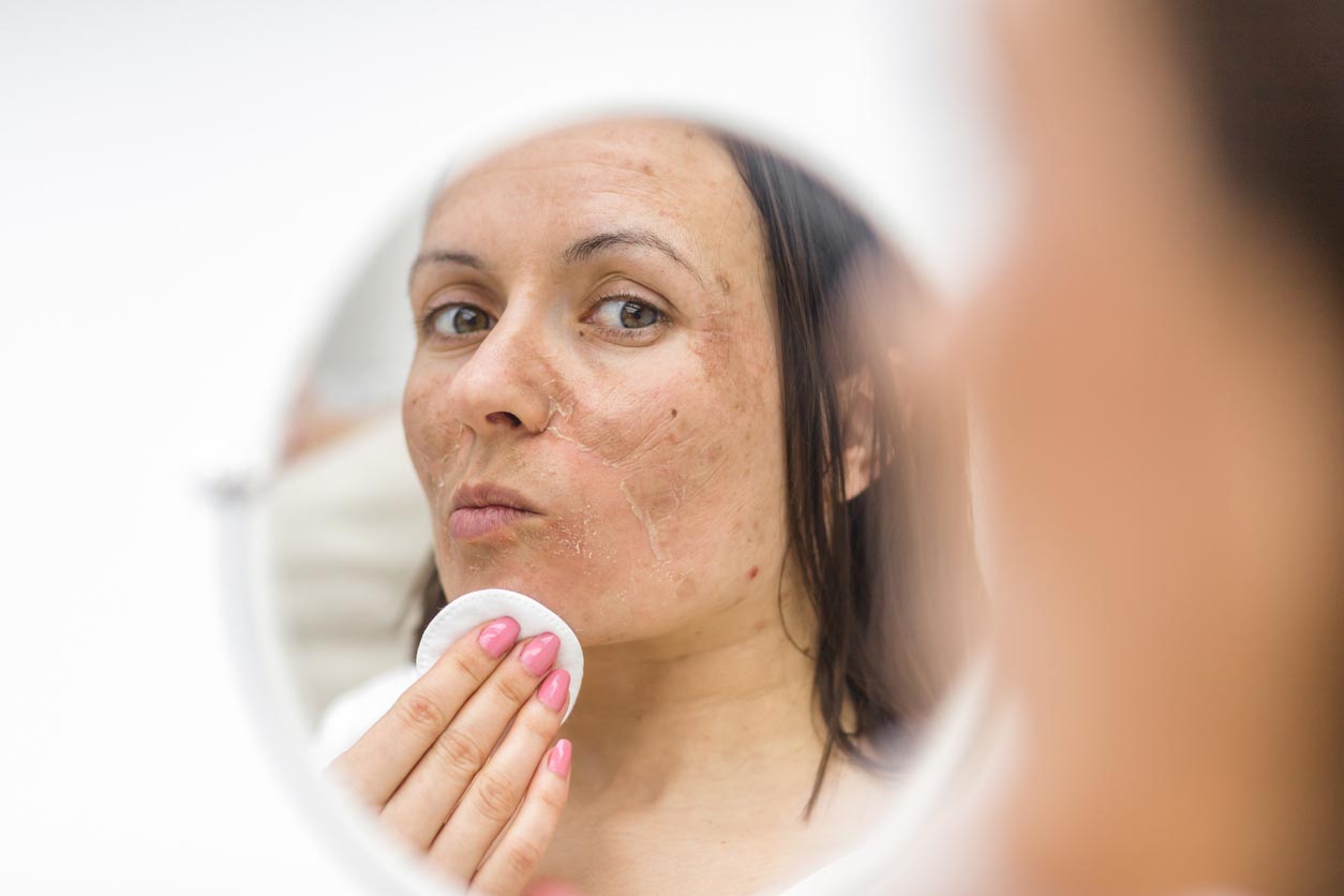 Photo d’une femme ayant des problèmes de peau