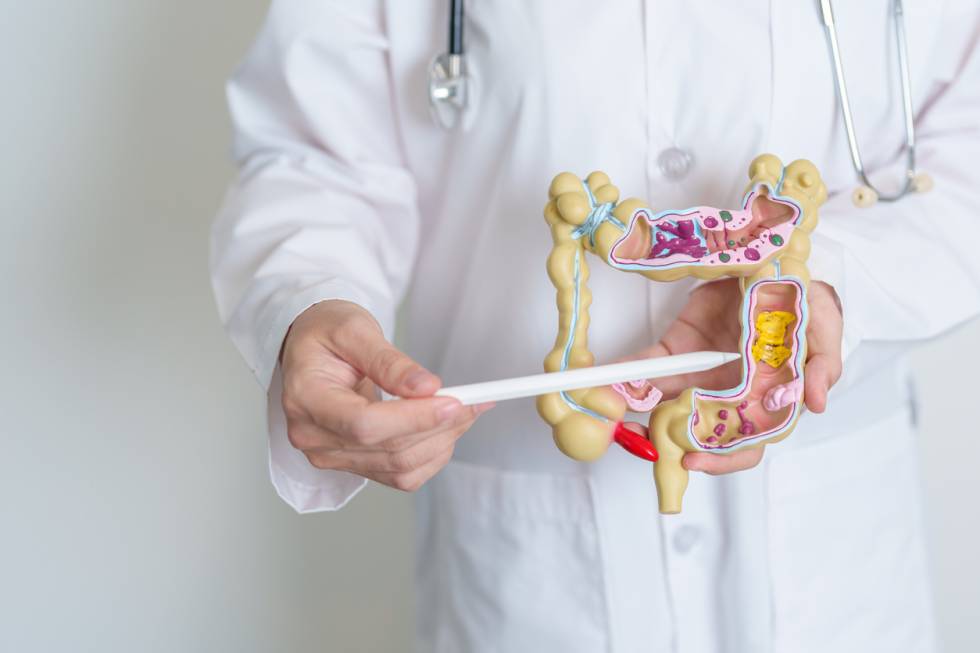 Maladie de Crohn intestin