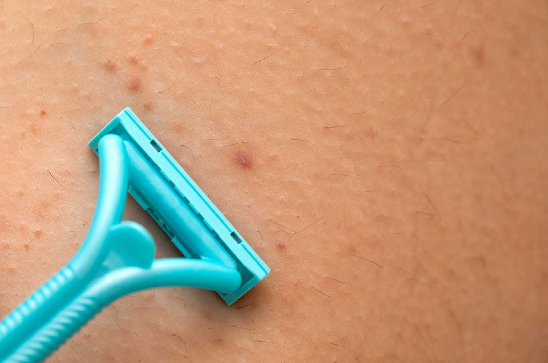 Lingettes Après épilation - Lot De 20, éliminent Résidus De Cire, Apaisent La Peau
