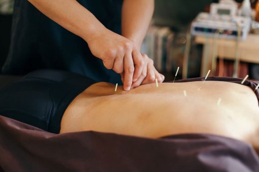 Acupuncture Médecine Chinois